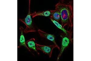 Immunofluorescence analysis of Hela cells using NBN mouse mAb (green).
