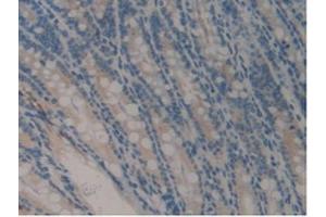 IHC-P analysis of Mouse Intestine Tissue, with DAB staining. (COMP anticorps  (AA 554-753))