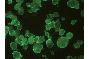 Immunocytochemistry detection of HSV by monoclonal antibody T111 in infected cells.