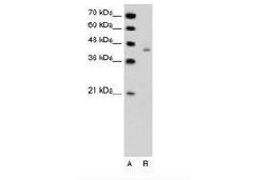 Image no. 1 for anti-DEAH (Asp-Glu-Ala-His) Box Polypeptide 30 (DHX30) (AA 51-100) antibody (ABIN6736327) (DHX30 anticorps  (AA 51-100))