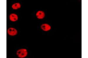 ABIN6266522 staining HepG2 by IF/ICC.