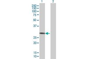 Lane 1: ETFB transfected lysate ( 27. (ETFB 293T Cell Transient Overexpression Lysate(Denatured))