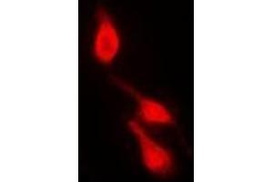 Immunofluorescent analysis of p38 (pY182) staining in HepG2 cells. (MAPK14 anticorps  (pTyr182))