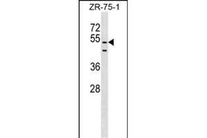 PDZD3 Antibody (Center) (ABIN1538201 and ABIN2849222) western blot analysis in ZR-75-1 cell line lysates (35 μg/lane). (PDZD3 anticorps  (AA 258-285))