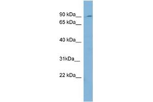 WB Suggested Anti-PREP  Antibody Titration: 0. (PREP anticorps  (Middle Region))