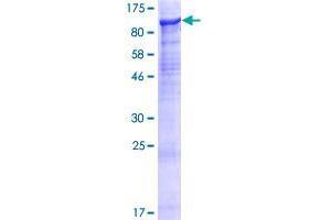 Image no. 1 for Sushi Domain Containing 2 (SUSD2) (AA 1-822) protein (GST tag) (ABIN1321929)