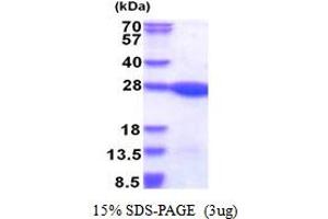 SDS-PAGE (SDS) image for Leucine Zipper and CTNNBIP1 Domain Containing (LZIC) (AA 1-190) protein (His tag) (ABIN5853475)