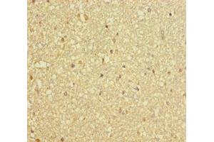 Immunohistochemistry of paraffin-embedded human brain tissue using ABIN7150811 at dilution of 1:100