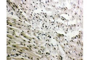 IHC-P: GR antibody testing of rat heart tissue (GR (AA 20-199) anticorps)