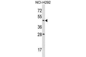 ACTL7B Antibody (N-term) western blot analysis in NCI-H292 cell line lysates (35µg/lane). (Actl7b anticorps  (N-Term))