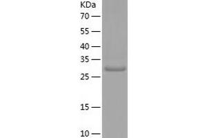 Western Blotting (WB) image for Adenosylmethionine Decarboxylase 1 (AMD1) (AA 68-334) protein (His-IF2DI Tag) (ABIN7121713)