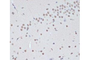Immunohistochemistry of paraffin-embedded Mouse brain using Phospho-Jak2(Y1007/1008) Polyclonal Antibody at dilution of 1:200 (40x lens). (JAK2 anticorps  (pTyr1007, pTyr1008))