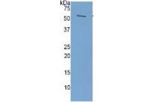 WB of Protein Standard: different control antibodies  against Highly purified E.