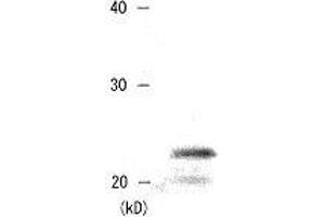 Western Blotting (WB) image for anti-Chromobox Homolog 5 (CBX5) (AA 179-191) antibody (ABIN2452033) (CBX5 anticorps  (AA 179-191))