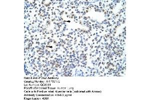Human Lung (POGZ anticorps  (N-Term))