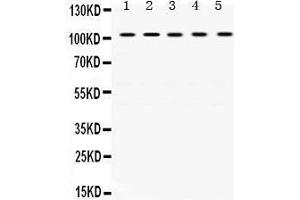 Western Blotting (WB) image for anti-Tripartite Motif Containing 28 (TRIM28) (AA 699-835) antibody (ABIN3043491)