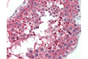 Anti-CNOT3 antibody IHC staining of human testis. (CNOT3 anticorps  (AA 141-190))