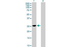 Western Blot analysis of TPD52 expression in transfected 293T cell line by TPD52 MaxPab polyclonal antibody. (TPD52 anticorps  (AA 1-184))