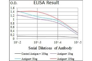 Immunohistochemical analysis of paraffin-embedded esophageal cancer tissues using CD59 antibody with DAB staining. (CD59 anticorps  (AA 31-111))