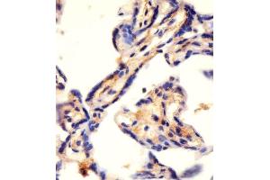 (ABIN655062 and ABIN2844692) staining CAD in human placenta tissue sections by Immunohistochemistry (IHC-P - paraformaldehyde-fixed, paraffin-embedded sections).