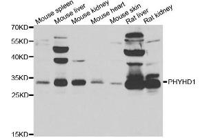 Western blot analysis of extracts of various cell lines, using PHYHD1 antibody.