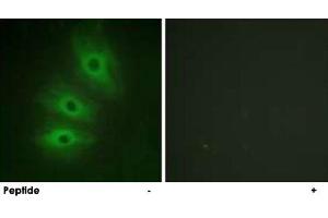 Immunofluorescence analysis of HeLa cells, using ADCY5/ADCY6 polyclonal antibody .