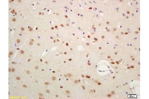 Formalin-fixed and paraffin embedded rat brain labeled with Anti-SIAH1 Polyclonal Antibody, Unconjugated (ABIN701350) at 1:200 followed by conjugation to the secondary antibody and DAB staining