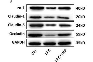 TMP has a protective effect on the LPS-induced BBB destruction in sepsis. (Occludin anticorps  (AA 263-522))