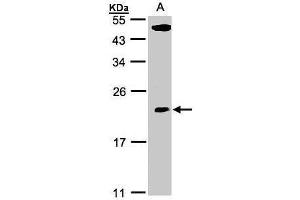 WB Image Sample(30 ug whole cell lysate) A:293T 12% SDS PAGE antibody diluted at 1:500 (TPRKB anticorps)