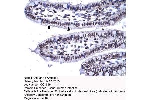Human Intestine (MYF6 anticorps  (N-Term))