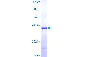 Image no. 1 for Mannosyl (Alpha-1,6-)-Glycoprotein beta-1,6-N-Acetyl-Glucosaminyltransferase (MGAT5) (AA 642-739) protein (GST tag) (ABIN1310832)