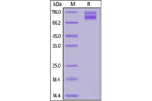 Human IL17RA & IL17RC Protein, Fc Tag&Fc Tag on  under reducing (R) condition.