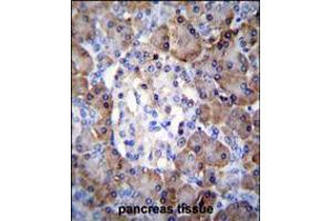 TIMP1 Antibody immunohistochemistry analysis in formalin fixed and paraffin embedded human pancreas tissue followed by peroxidase conjugation of the secondary antibody and DAB staining. (TIMP1 anticorps  (C-Term))