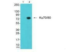Western blot analysis of extracts from JK cells (Lane 2), using Ku80 antiobdy. (XRCC6 anticorps)