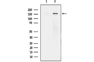 anti-Topoisomerase (DNA) II Binding Protein 1 (TOPBP1) (Internal Region) antibody
