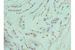 Immunohistochemistry of paraffin-embedded human prostate tissue using ABIN7144586 at dilution of 1:100 (ARG2 anticorps  (AA 1-354))