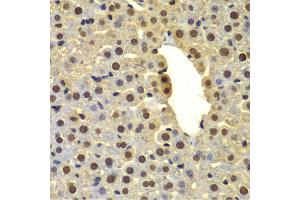Immunohistochemistry of paraffin-embedded mouse liver using DTX2 antibody. (DTX2 anticorps)