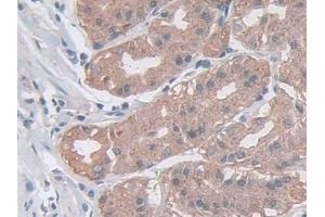 Detection of ASAH1 in Human Stomach Tissue using Polyclonal Antibody to N-Acylsphingosine Amidohydrolase 1 (ASAH1)