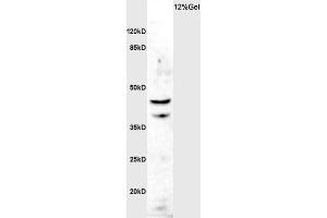Rat brain lysate probed with Rabbit Anti-ASMTY Polyclonal Antibody, Unconjugated  at 1:3000 for 90 min at 37˚C. (ASMT anticorps)