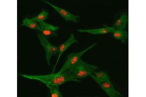 IF analysis of TSEN34 and Tubulin beta using anti-TSEN34 antibody (ABIN7599254) and anti-Tubulin beta antibody (ABIN7602744). (TSEN34 anticorps  (AA 1-310))