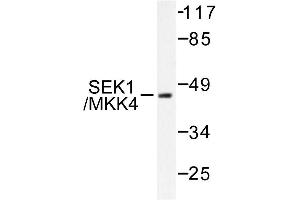 Image no. 1 for anti-Mitogen-Activated Protein Kinase Kinase 4 (MAP2K4) antibody (ABIN271811) (MAP2K4 anticorps)