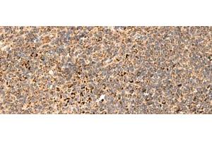 Immunohistochemistry of paraffin-embedded Human tonsil tissue using REG1B Polyclonal Antibody at dilution of 1:55(x200) (REG1B anticorps)