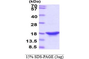 SDS-PAGE (SDS) image for Synuclein, beta (SNCB) protein (ABIN666819) (beta Synuclein Protéine)