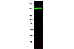 Western blot using  affinity purified anti-iASPP antibody shows detection of a band at ~100 kDa (arrowhead) corresponding to isoform 1 of iASPP in MCF7 whole cell lysates.
