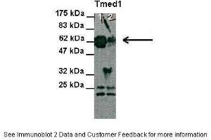 Lanes:   Lane 1 and 2: 30 ug HEK-293 cell lysate  Primary Antibody Dilution:   1:1000  Secondary Antibody:   Anti-Rabbit HRP  Secondary Antibody Dilution:   1:2000  Gene Name:   Tmed1  Submitted by:   Anonymous (TMED1 anticorps  (N-Term))