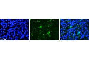Rabbit Anti-FBXW7 Antibody     Formalin Fixed Paraffin Embedded Tissue: Human Pineal Tissue  Observed Staining: Cytoplasmic in cell bodies and processes of pinealocytes  Primary Antibody Concentration: 1:100  Other Working Concentrations: 1/600  Secondary Antibody: Donkey anti-Rabbit-Cy3  Secondary Antibody Concentration: 1:200  Magnification: 20X  Exposure Time: 0. (FBXW7 anticorps  (C-Term))