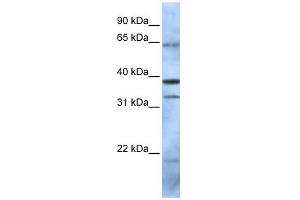 PCGF5 antibody used at 1 ug/ml to detect target protein. (PCGF5 anticorps  (N-Term))