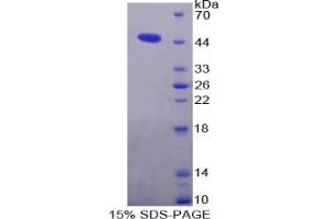 SDS-PAGE of Protein Standard from the Kit (Highly purified E.