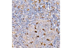Immunohistochemistry of paraffin-embedded mouse spleen using IFN Rabbit pAb (ABIN3015552, ABIN3015553, ABIN1680393 and ABIN6218813) at dilution of 1:100 (40x lens).