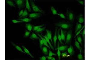 Image no. 2 for anti-PDZ Binding Kinase (PBK) (AA 1-110) antibody (ABIN599275) (PBK anticorps  (AA 1-110))